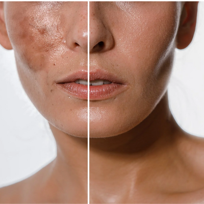 combo crema aclaradora y serum antiedad